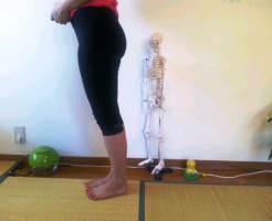 ヒップアップの施術前後の写真